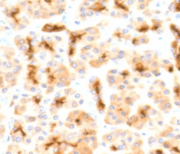 CFTR Recombinant Antibody / Cystic Fibrosis Transmembrane Regulator - image 1