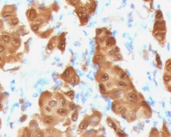 S100B Recombinant Antibody - image 1
