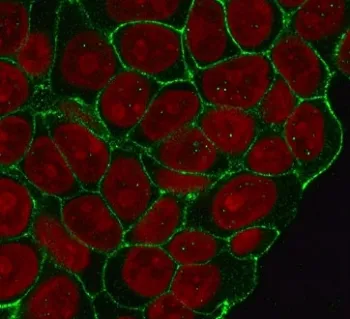 Beta Catenin Recombinant Antibody - image 1