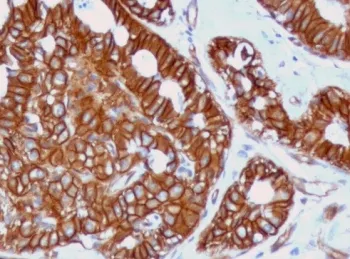 Beta Catenin Recombinant Antibody - image 1