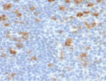 Kappa Light Chain Antibody - image 1