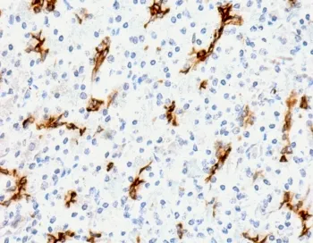 MUC6 Recombinant Antibody / Gastric Mucin - image 1