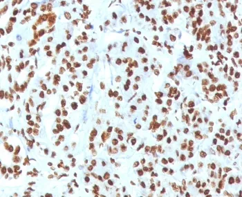 Histone H1 Recombinant Antibody - image 1