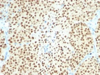 SOX10 Recombinant Antibody - image 1