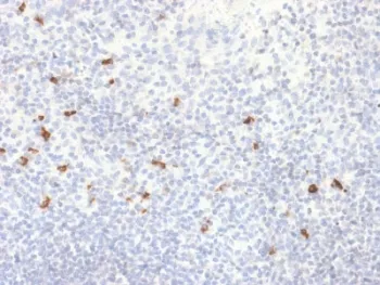 Human IgG4 Recombinant Antibody - image 1