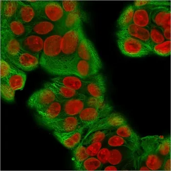 Multi Cytokeratin Recombinant Antibody - image 1