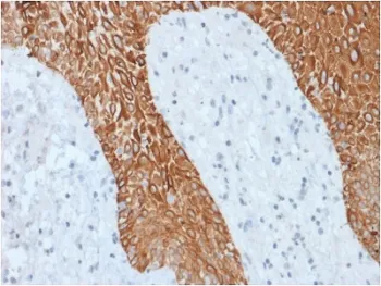 Multi Cytokeratin Recombinant Antibody - image 1