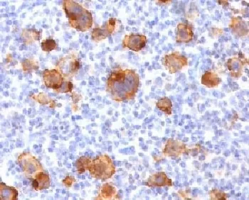 CD30 Recombinant Antibody - image 1