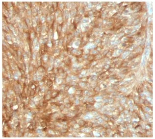Beta-2 Microglobulin Recombinant Antibody - image 1
