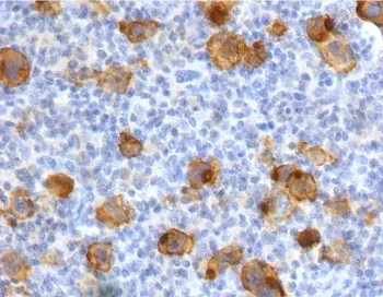 CD30 Recombinant Antibody - image 1
