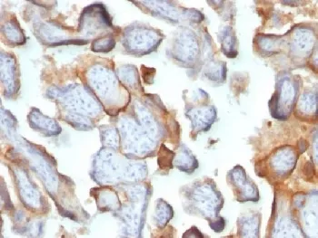 HCG-beta Antibody - image 1