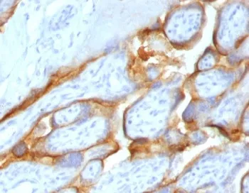 HCG-beta Recombinant Antibody - image 1