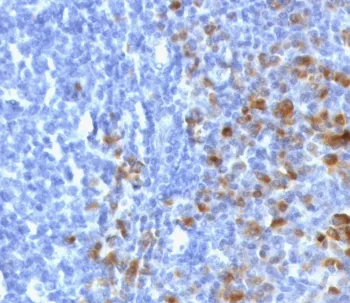 IgG Heavy Chain Recombinant Antibody - image 1