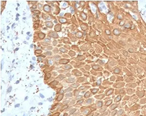 Multi Cytokeratin Recombinant Antibody - image 1