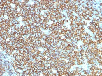 CD20 Recombinant Antibody - image 1