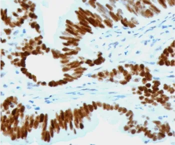 p53 Recombinant Antibody / TP53 - image 1