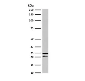 CD3 epsilon Antibody - image 1