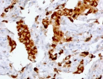 Napsin A Recombinant Antibody - image 1
