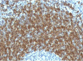 CD79b Antibody - image 1