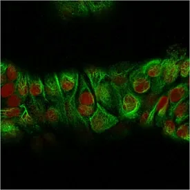 Basic Cytokeratin Recombinant Antibody - image 1