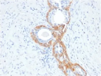 Basic Cytokeratin Recombinant Antibody - image 1