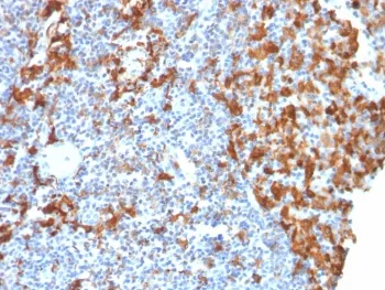 IBA1 Recombinant Antibody / AIF-1 - image 1