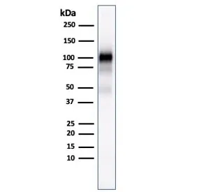 Glycoprotein 2 Antibody / GP2 / ZAP75 - image 1