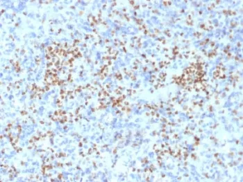 PU.1 Antibody / SPI1 - image 1