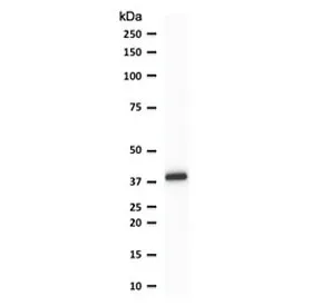 PU.1 Antibody / SPI1 - image 1