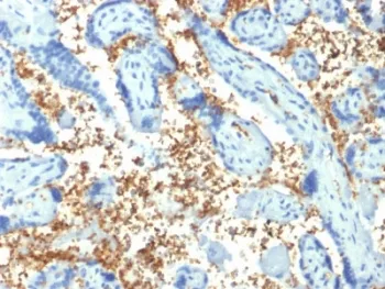 SPTA1 Antibody / Spectrin alpha 1 - image 1