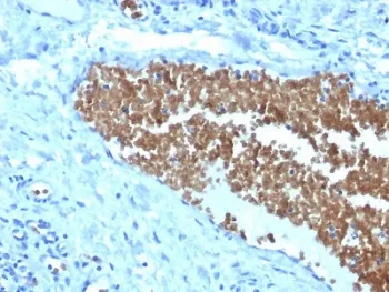 SPTA1 Antibody / Spectrin alpha 1 - image 1