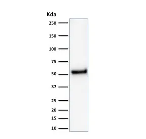 p53 Recombinant Antibody / TP53 - image 1