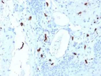 TPSAB1 Antibody / Mast Cell Tryptase - image 1