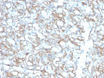PD-L1 Antibody / B7-H1 / CD274 - image 1