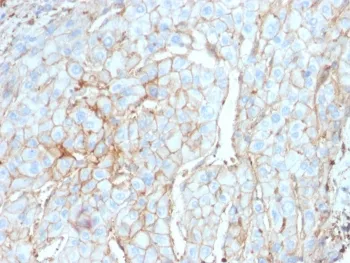 PD-L1 Antibody / B7-H1 / CD274 - image 1
