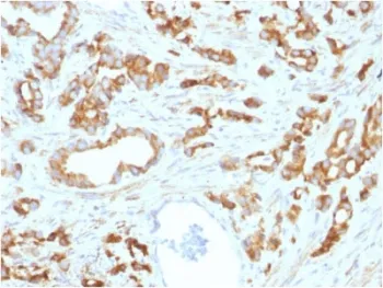 Aurora B Antibody / AURKB - image 1