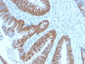 CDX2 Recombinant Antibody - image 1