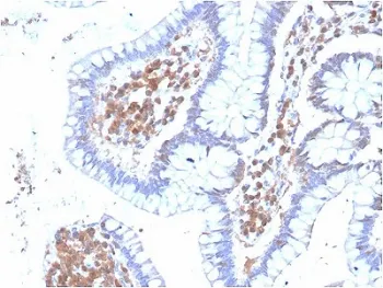 p38 MAPK Antibody / MAPK14 - image 1
