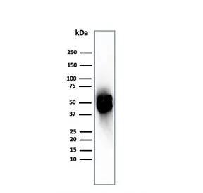 Thymidine Phosphorylase Recombinant Antibody / PD-ECGF - image 1