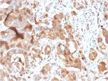 FABP5 Antibody (epidermal) - image 1
