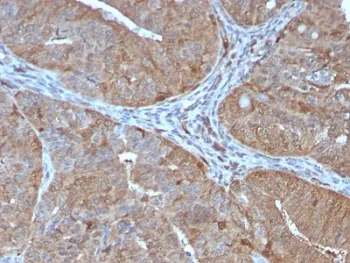 AKR1B1 Antibody / Aldose reductase - image 1