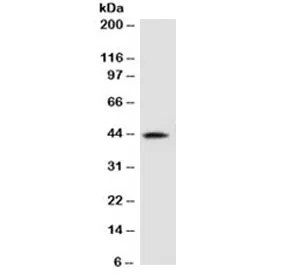 AMACR / p504S Antibody (Prostate Cancer Marker) - image 1