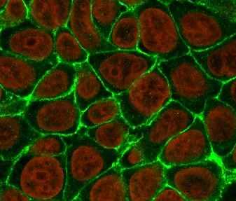 EpCAM Antibody - image 1