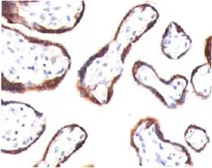 HCG-beta Antibody - image 1