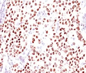 Progesterone Receptor Antibody - image 1
