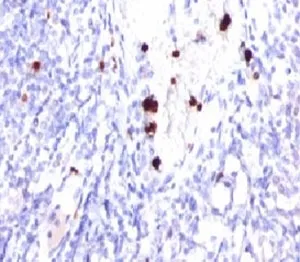 CSF3 Antibody / Granulocyte-Colony Stimulating Factor - image 1