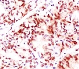 Estrogen Receptor beta Antibody - image 1