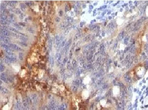 Secretory Component p85 Recombinant Antibody / ECM1 - image 1