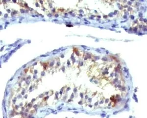 Prolactin Receptor Antibody / PRLR - image 1
