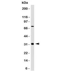Bcl10 Antibody - image 1